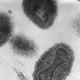 Microscopía electrónica del Virus Variola, responsable de la viruela humana, en una imagen de 1975. Foto: Wikipedia